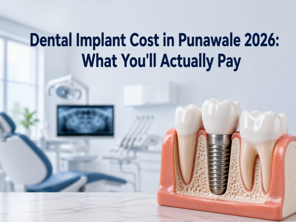 Dental implant treatment in Punawale